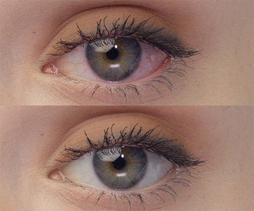 Before and after shot of an eye after using Lumify eye drops